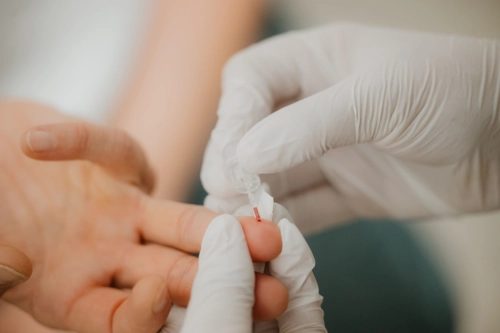 bluttest-mit-blut Entnahme von Kapillarblut